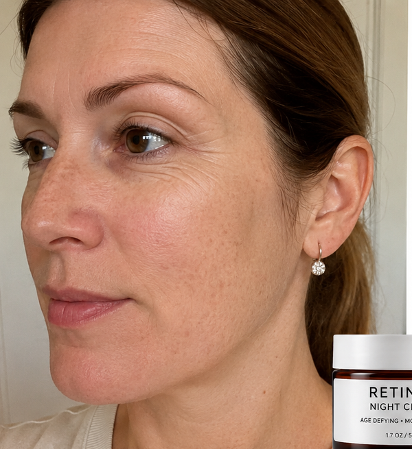 Before - Retinol Night Cream